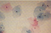 Unauffälliger PAP-Abstrich - Grad II